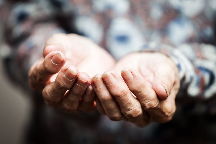 Beggar people and human poverty concept. Needing help.